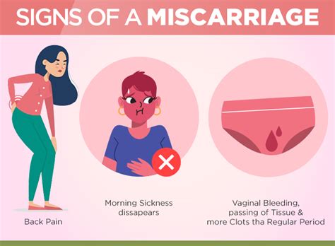 Recurrent Pregnancy Loss Miscarriage Treatment Gurgaon
