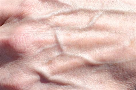 Background Skin Male Hands With Protruding Veins Stock Photo Download