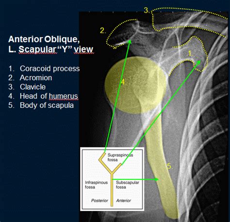 Imaging Unit 9 Radiography Of The Shoulder Girdle And Shoulder