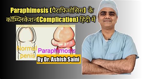 Paraphimosis पैराफिमोसिस के Complication Patient Case Series Youtube