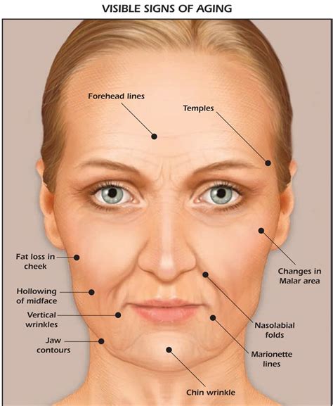 Using Fillers For Cheeks Charleston Facial Plastic Surgery