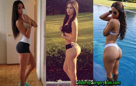 Jen Selter Before And After Nose