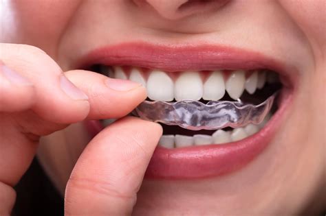 How And Why Invisalign Treatment Is Better Than Metal Braces — Valley