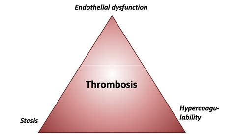 25 Thrombosis And Embolus Definitions Causes Types And Clinical