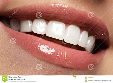 Perfect Smile Before And After Bleaching Dental Care And Whiten Stock