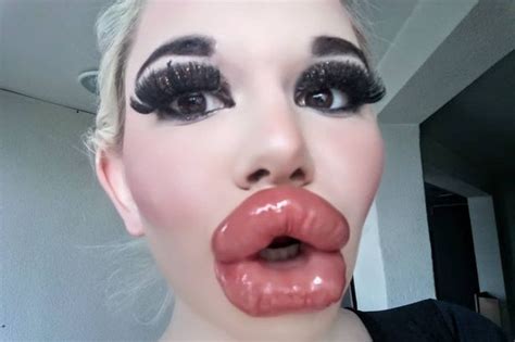 Woman With World S Biggest Lips Boosts Boobs By Four Sizes But