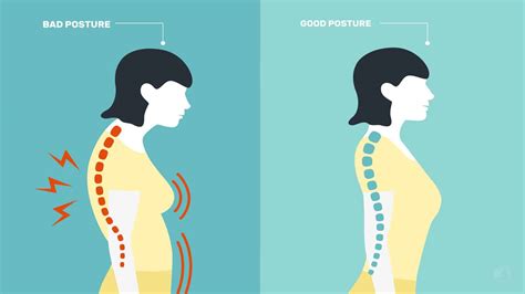 Yoga Poses To Fix Bad Posture