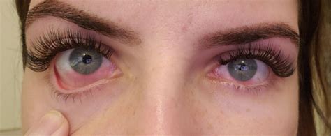 lash extensions irritated red lower eyes a fix r lashextensions