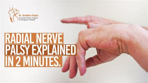 What Is Radial Nerve Palsy Radial Nerve Palsy Explained Dr Anubhav
