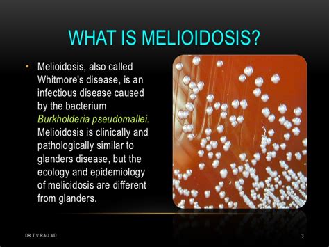 The causative bacterium is largely found in the soil, rice paddies and stagnant melioidosis prevention. Melioidosis