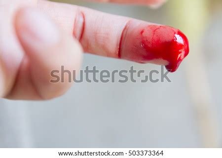 For performing a blood test, we need to collect so yes, blood tests hurt. Hand Cut Blood Stock Images, Royalty-Free Images & Vectors ...