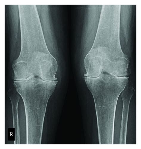 List 105 Pictures Knee Anatomy X Ray Excellent 102023