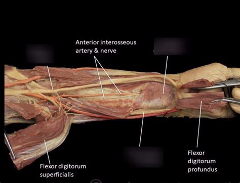 Anterior Deep Forearm Cadaver Diagram Diagram Quizlet