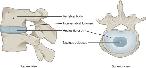 Disc Bulgeherniation Portland Physical Therapy