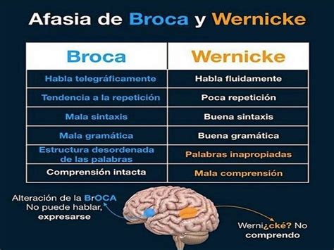 Broca's aphasia results from damage to a part of the brain called broca's area, which is located in the frontal lobe, usually on the left side. Infografía: Afasia de Broca y Wernicke - SNC PHARMA