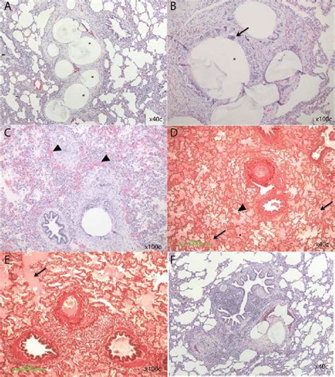 Browse the use examples 'parenchyma of lung' in the great english corpus. Example of pathology changes in lung parenchyma of distal lung lobes in... | Download Scientific ...