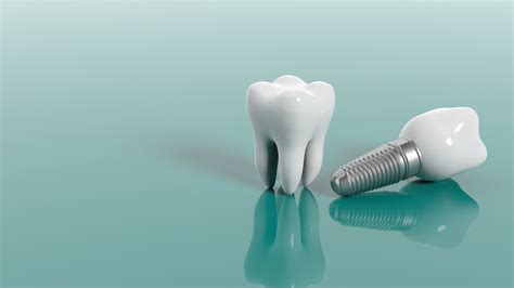 10 Preguntas Frecuentes Sobre Implantes Dentales Valvanera Clínica Dental