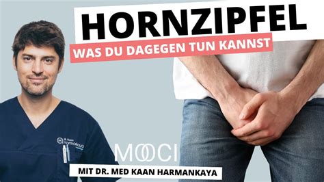 Hornzipfel Album Top Adult Videos And Photos