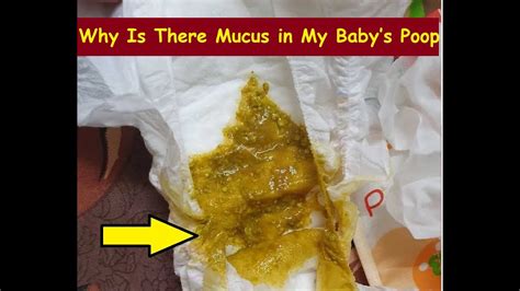 Why Is There Mucus In My Babys Poop Youtube