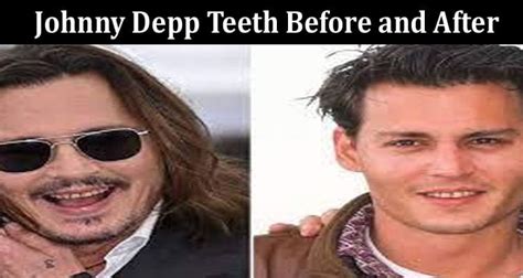 Johnny Depp Teeth Before And After Who Is Amber Heard Explore