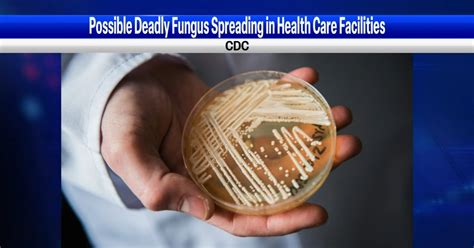 Deadly Fungal Infection Spreading At An Alarming Rate Cdc Says