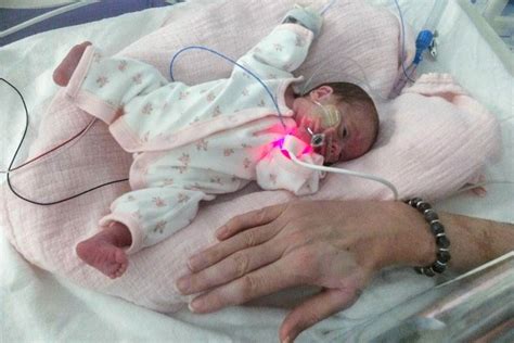 Uks Most Premature Baby Is Now Two And Thriving