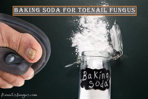 Baking Soda For Toenail Fungus Ultimate Guide 2023
