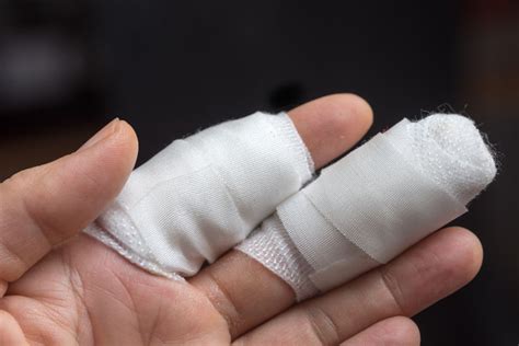 How To Sue Your Employer For A Broken Finger Injury At Work A Guide