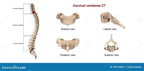 Cervical Vertebrae C6 Royalty Free Stock Image
