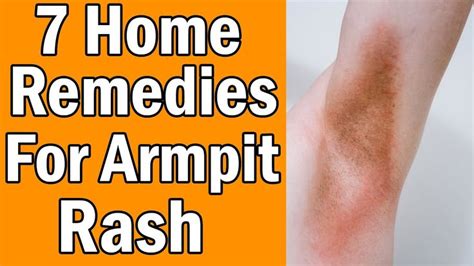 7 Home Remedies For Armpit Rash In 2020 Armpit Rash Home Remedies