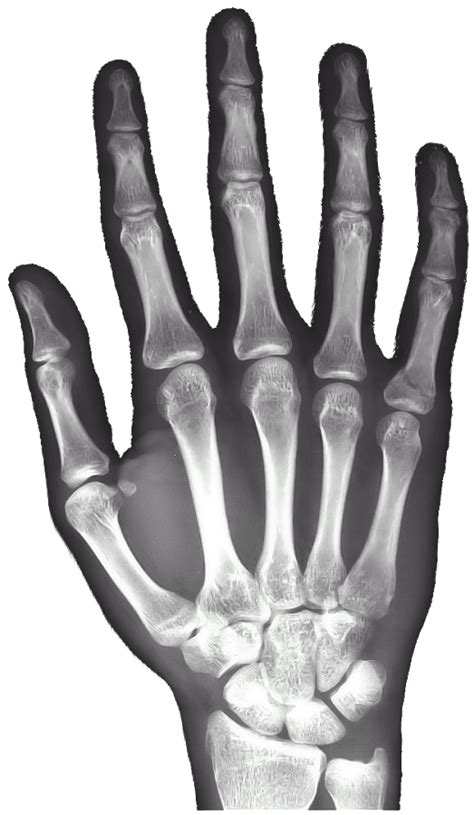 X Rays Png Transparent Image Download Size 523x900px
