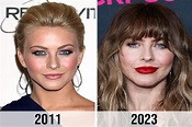 Did Julianne Hough Get Plastic Surgery? Before and After Photos ...