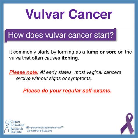 Vulvar Cancer Stages