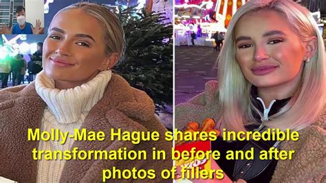 Molly Mae Hague Shares Incredible Transformation In Before And After