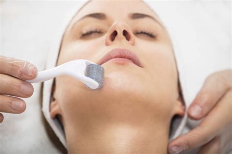 Microneedling Important Facts
