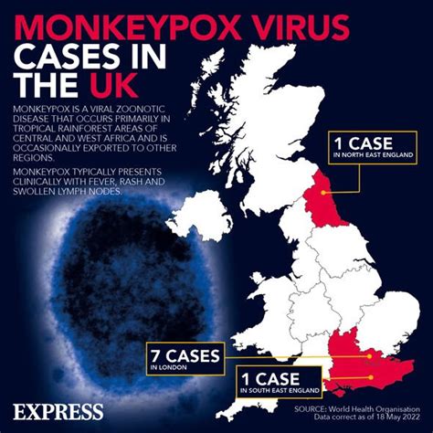 Monkeypox Symptoms How To Tell Rash Apart From A Covid Rash Key