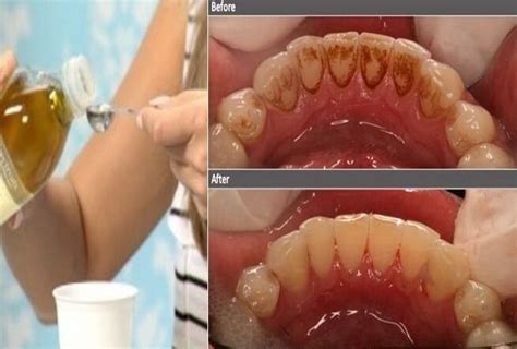 only one ingredient and say goodbye to bad breath plaque tartar and