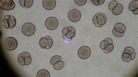 Fungus Identification Microscope Micropedia