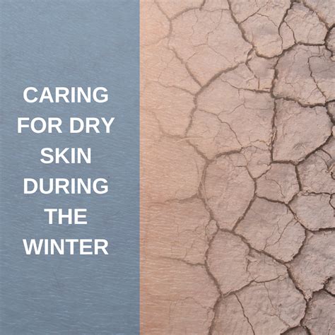 How To Care For Dry Skin During The Winter