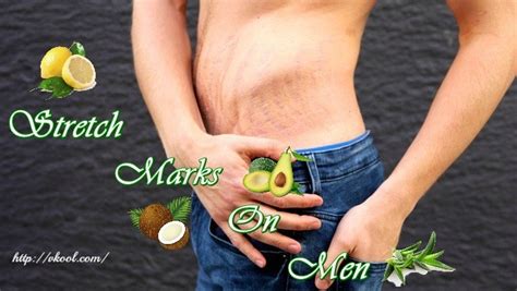 15 Ways On How To Remove Stretch Marks On Men