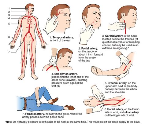 Stop Bleeding By Pinching These Universal Pressure Points First Aid