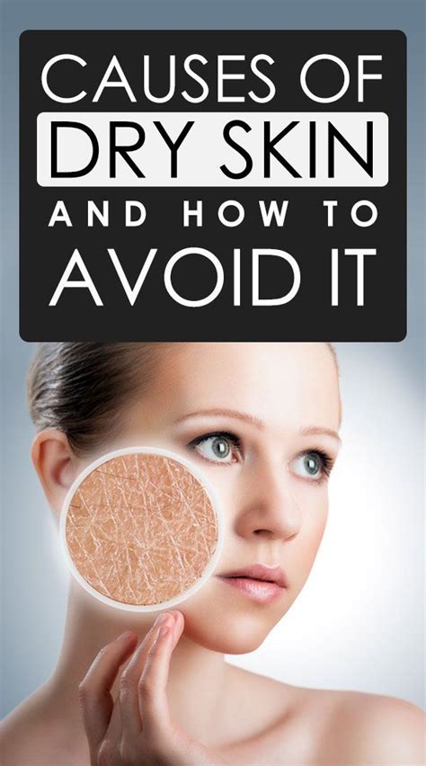 Causes Of Dry Skin And How To Avoid It In 2021 Dry Facial Skin