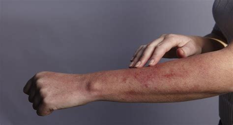 What Is A Red Rash Under The Skin