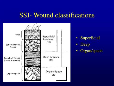 Ppt Surgical Wounds And Antimicrobial Prophylaxis Powerpoint