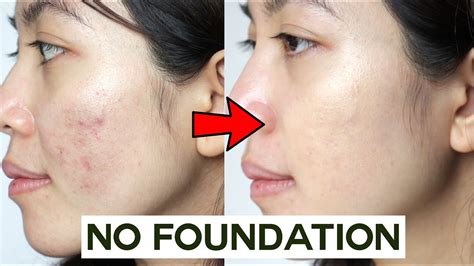 How To Cover Acne And Blemishes Without Foundation • Easy And Non Cakey