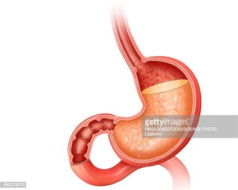 What Color Is Stomach Acid Photos And Premium High Res Pictures Getty Images