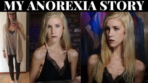 Anorexia Success Story Atilaval