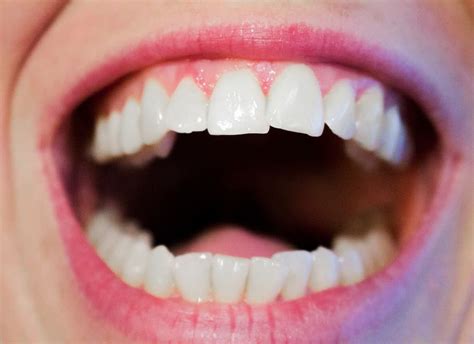 Human S Teeth Teeth Dentist Dental Mouth White Hygiene Dentistry Piqsels
