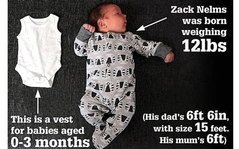 Are The Scales Broken 12lb Baby Zack Weighed Twice By Stunned Midwives