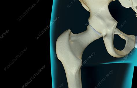 The Bones Of The Hip Stock Image F0015218 Science Photo Library